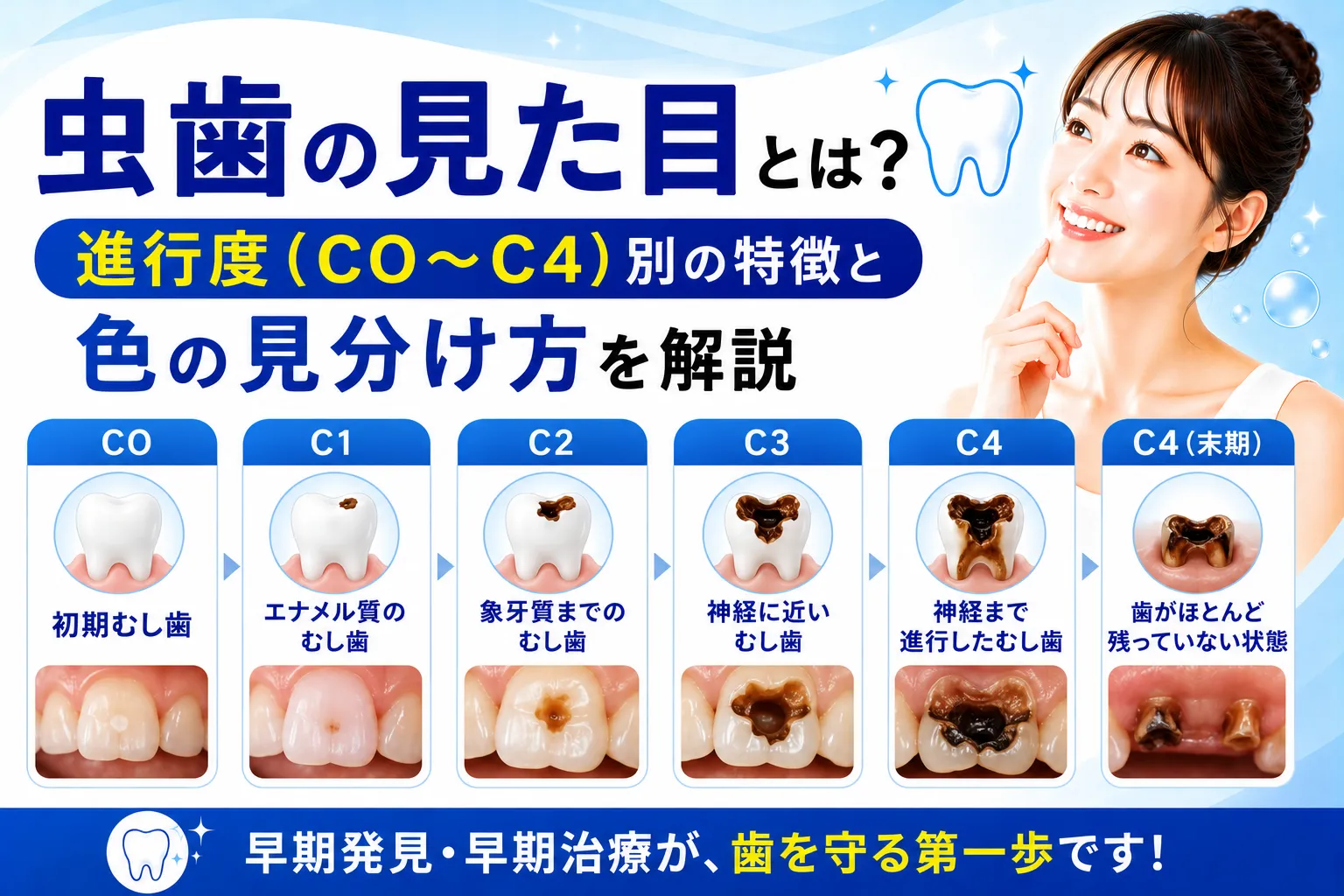 虫歯 c2 見た目